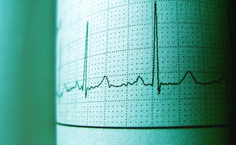 call retry frequency monitoring
